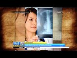 Todays History 8 November Hari Radiologi Internasional - IMS