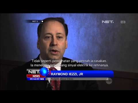 Peneliti temukan sebuah alat penyembuh kebutaan - NET5