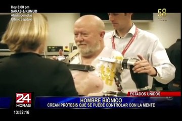 EEUU: crean prótesis que se controlan con la mente