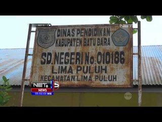 Dua Bocah Alami Luka Serius Akibat Dibakar Temannya - NET 5