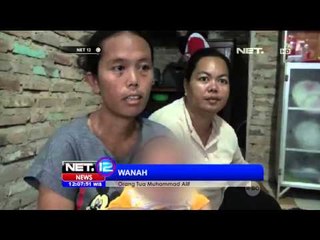 Bayi Penderita Tumor Wajah - NET12