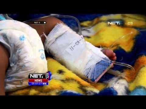 Pasien Demam Berdarah Meningkat Di Jombang, Jawa Timur - NET5