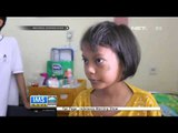 Relawan Yayasan Onkologi Anak Medan Hibur Anak Penderita Kanker - IMS
