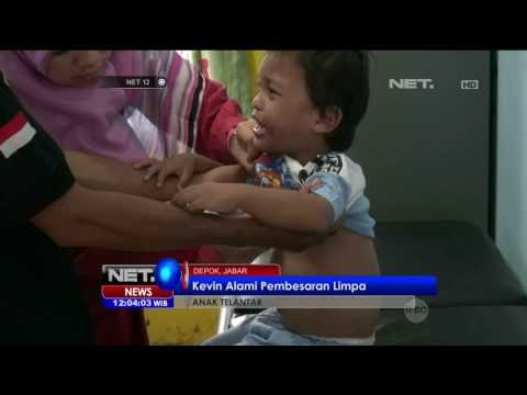 Kevin Anak Terlantar Keluhkan Sakit Pada Perutnya - NET12