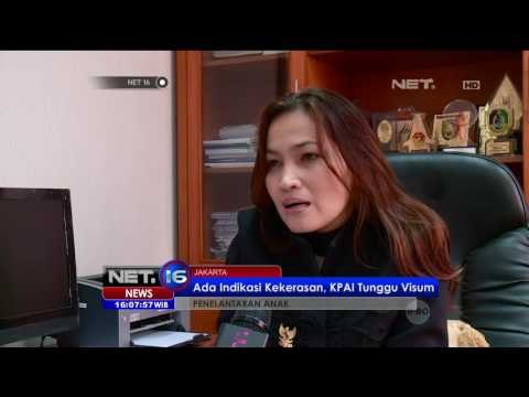 Kondisi Terkini Kasus Penelantaran Anak di Bellagio - NET16