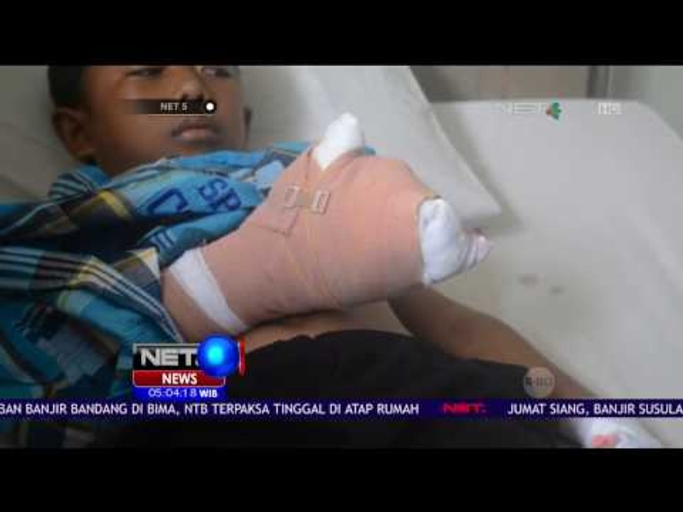 Bocah 10 Tahun Jadi Korban Ledakan Kembang Api – NET5