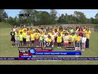 Conner Goldhammer, Penderita Osteogenesis yang Menginspirasi Dunia - NET12