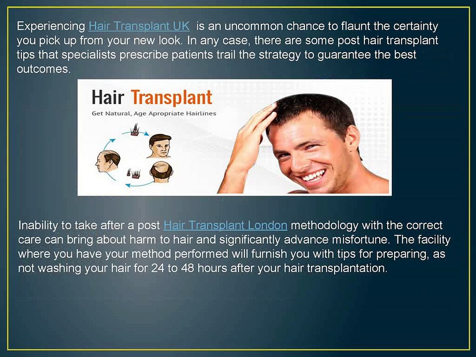 9_Top_Tips_for_Post_Hair_Transplant_Recovery