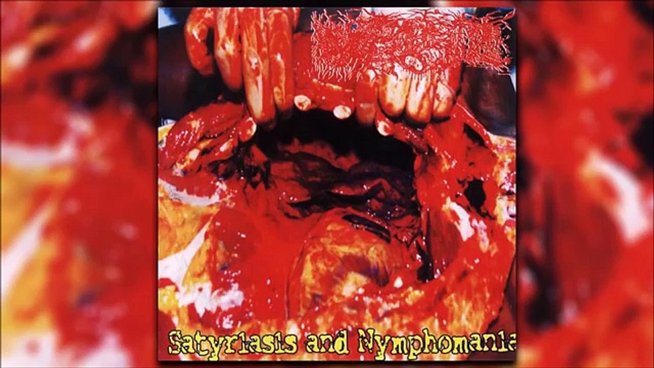 Paracoccidioidomicosisproc. Satyriasis And Nymphomania (Full Album)