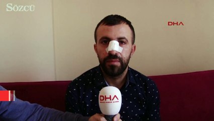 Hasta yakını, hemşirenin burnunu kırdı