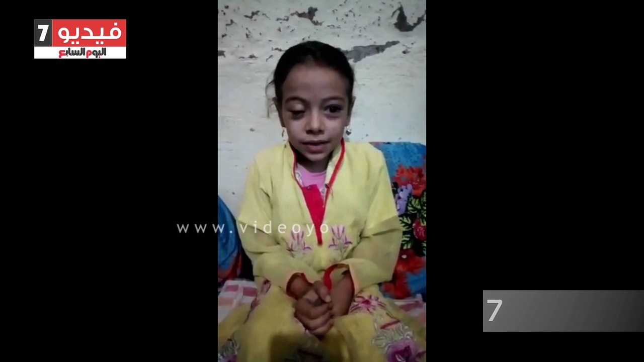 مادة كيميائية أفقدت الطفلة "نور" بصرها.. ووالده...