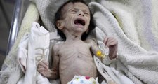 Bu Fotoğraf Suriye'de Çekildi! Açlıktan Kemikleri Sayılıyor