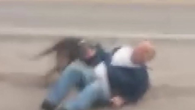 美서도 맹견에 7살 아이 숨져...매년 30명 사망 / YTN