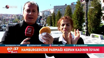 Dünya devi şokta! Hamburgercide parmağı koptu