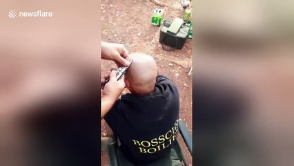 Fisherman gets hook stuck in his head