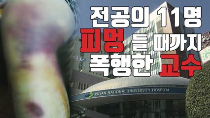 [자막뉴스] "피멍 들 때까지" 부산대 병원 교수, 전공의 상습 폭행 / YTN