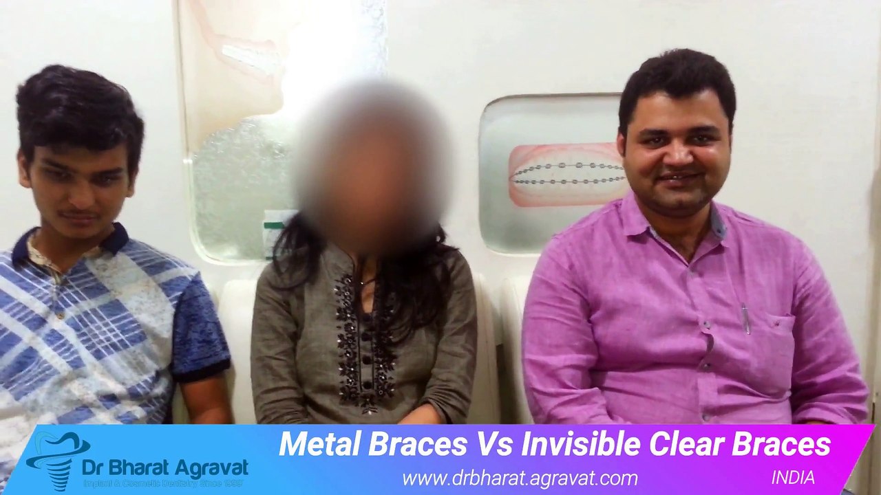 Metal Braces Vs Invisible Clear Braces Patient Stories Review by Cosmetic Dentist Ahmedabad, Gujarat, India Dr Bharat Agravat