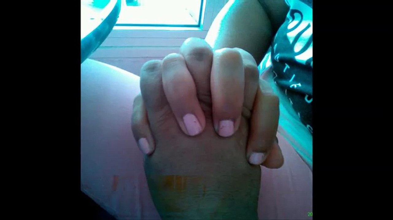 cheb Khalas ( elbereh gabdhat elvol )  ,  الشاب خلاص ( البارح قبضت الفول )