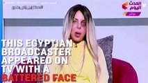 A Battered Face Raises Awareness Of Domestic Violence On Egyptian TV
