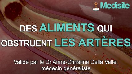 Top 3 des aliments qui obstruent les artères