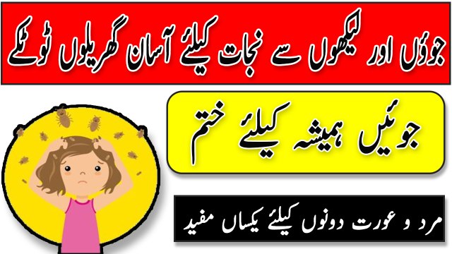 Sir ki juon ka Mukamal Khatma - Head Lice Treatment In Urdu - How To Get Rid Of Head Lice