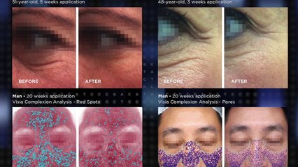 Dr. Firshein from New York is talking about anti-aging treatments