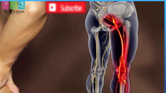 How To Relieve Sciatic Nerve Pain - Treatment For Sciatic Nerve
