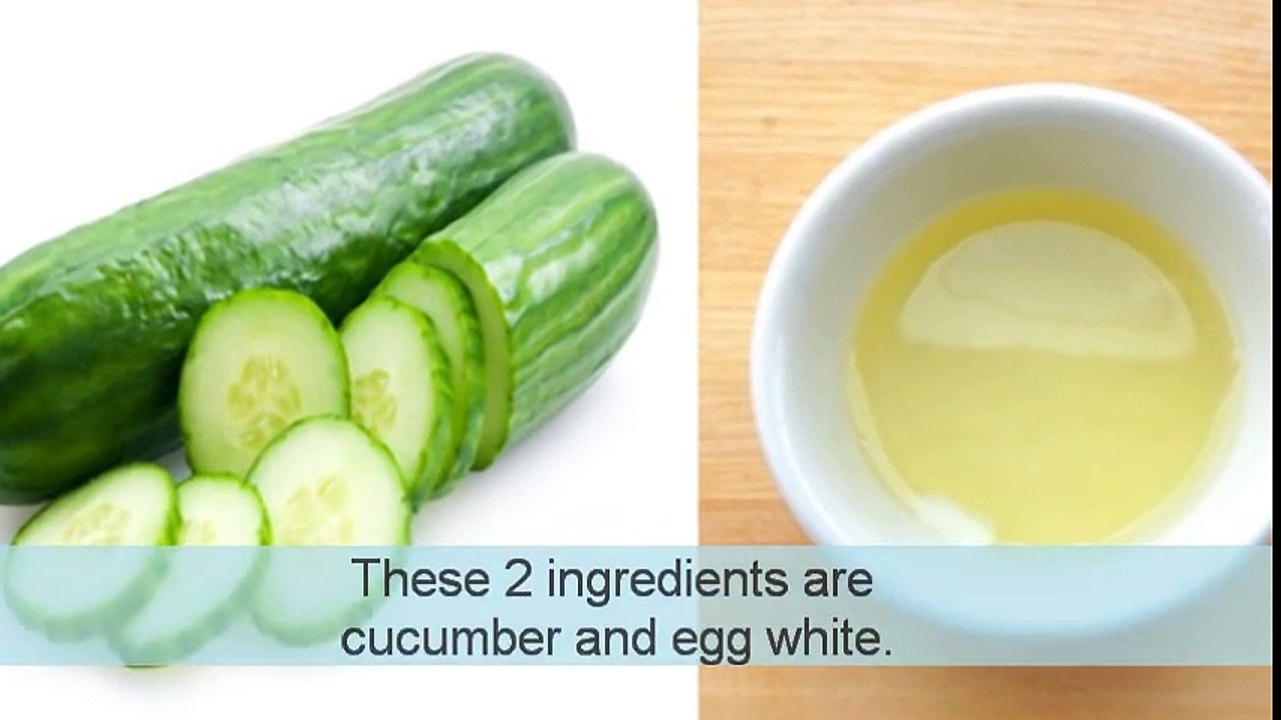 How To Remove Mouth Wrinkles In 3 Days - Lift Corners Of Your Mouth Naturally!