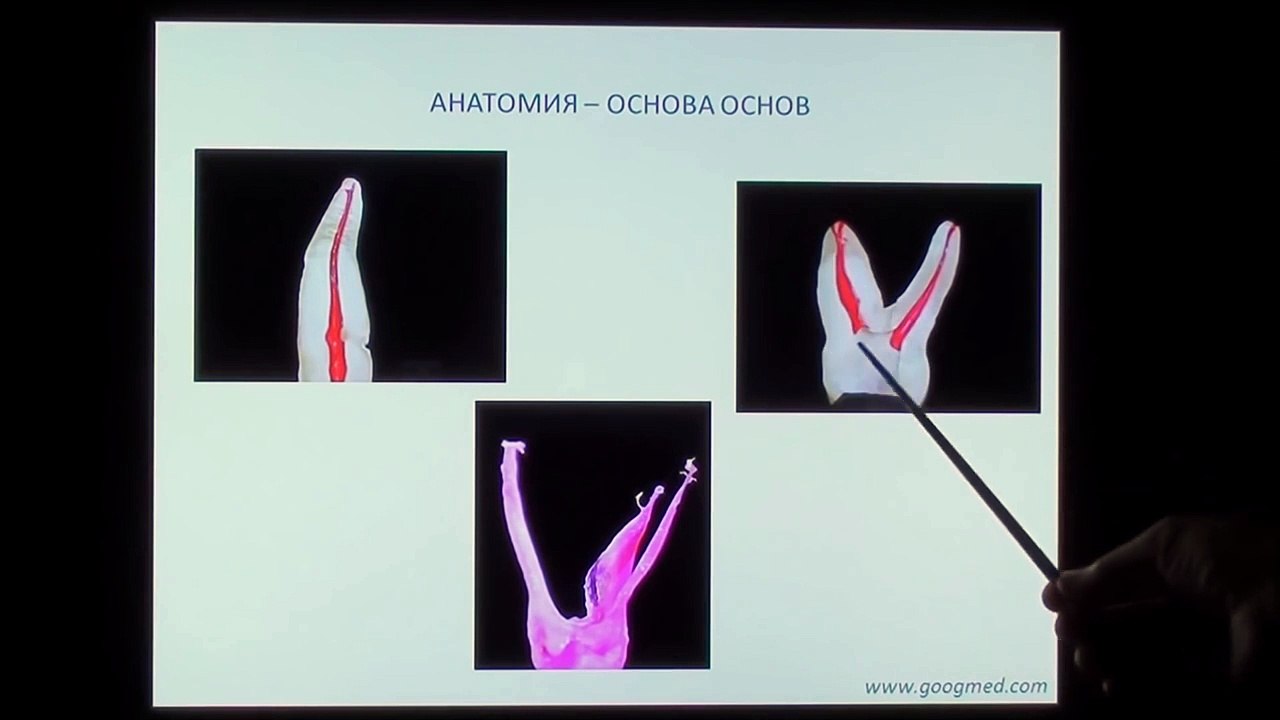 Как оределить длину корневого канала при пломбирование Советы стоматолога Эндодонтия