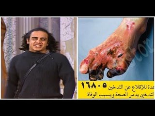 أوس أوس يكشف حقيقة الصور على علب السجاير ...#تياترو_مصر