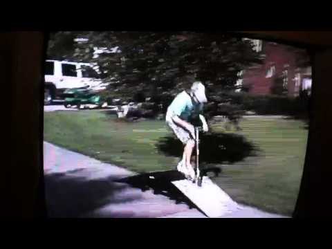 Boy Faceplants Into Pavement After Failed Scooter Landing