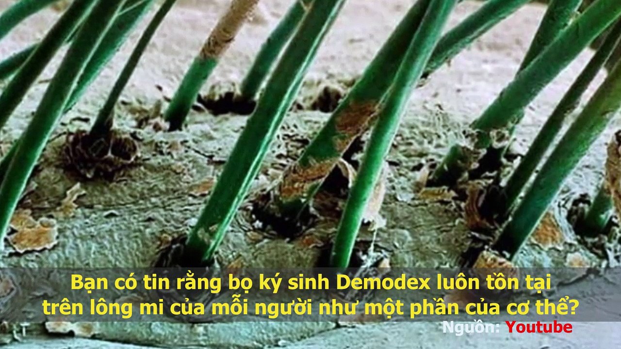 Sửng sốt trước vẻ đẹp “chết người” của những sinh vật dưới lăng kính hiển vi