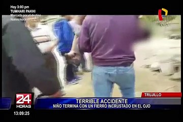 Trujillo: niño cae a pozo de agua y termina con fierro incrustado