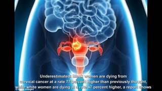 Cervical cancer rates woefully underestimated