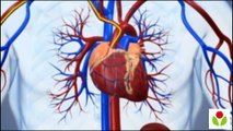 How Angioplasty Surgery is performed?