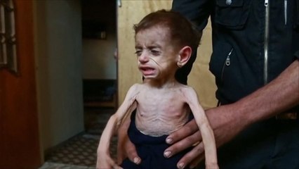 الموت في سوريا.. التجويع في الغوطة بعد الكيماوي بإدلب