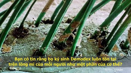 Sửng sốt trước vẻ đẹp “chết người” của những sinh vật dưới lăng kính hiển vi