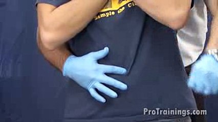 Conscious Adult Choking