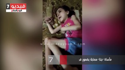 مأساة "جنا" مصابة بضمور فى المخ وكسر فى الحوض والركبة
