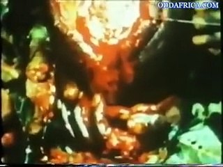 Brain Surgery Hip Hop Style