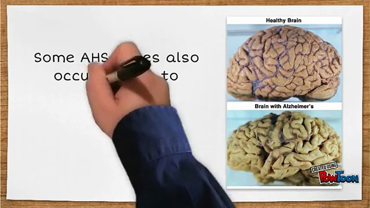 ALIEN HAND SYNDROME