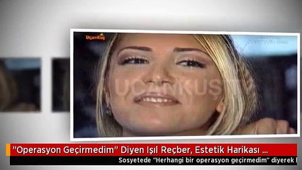 "Operasyon Geçirmedim" Diyen Işıl Reçber, Estetik Harikası Çıktı