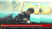 Sahtekar Dilencinin Koluna Sardığı 3 Kat Bandajı Açmak Dakikalar Sürdü