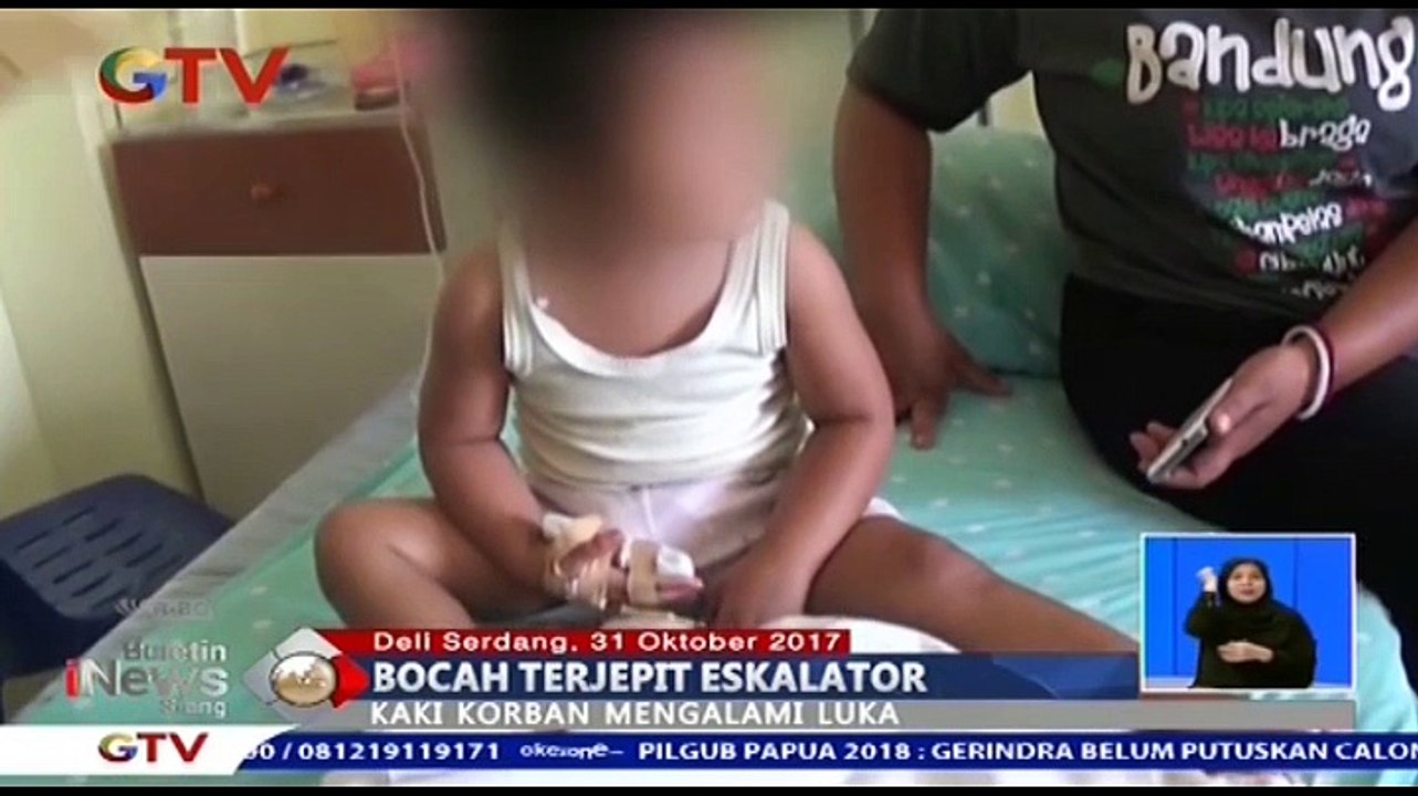 Bocah Terjepit Eskalator