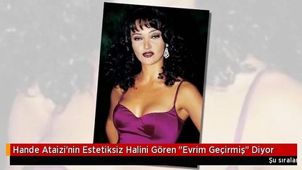 Hande Ataizi'nin Estetiksiz Halini Gören "Evrim Geçirmiş" Diyor