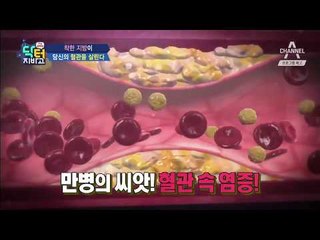 [닥터지바고 예고] 만병의 씨앗 혈관속 염증을 줄여줄 해결책은?