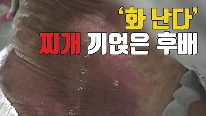 [자막뉴스] '화가 난다' 펄펄 끓는 찌개 끼얹은 후배 / YTN