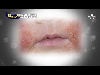 내 몸을 스스로 지키는 힘! 내 몸의 보디가드 면역력!!