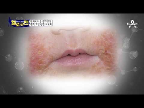 내 몸을 스스로 지키는 힘! 내 몸의 보디가드 면역력!!