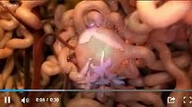 【NHKスペシャル予告動画】シリーズ 人体 神秘の巨大ネットワーク  プロローグ第１集 “腎臓”が寿命を決める